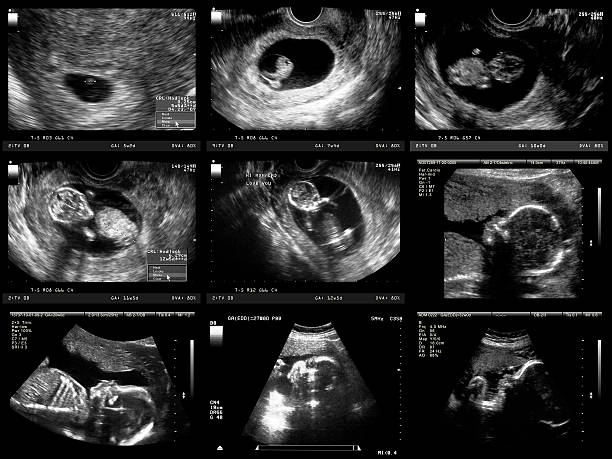 TIMT:: Ultrasound screening