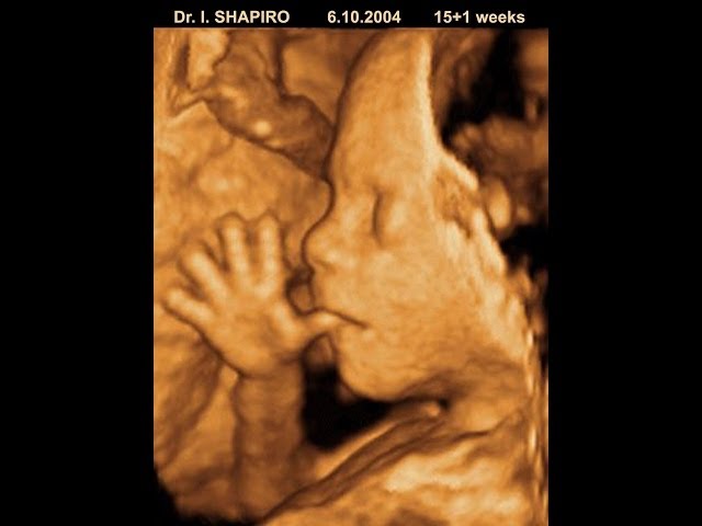 TIMT:: Ultrasound screening